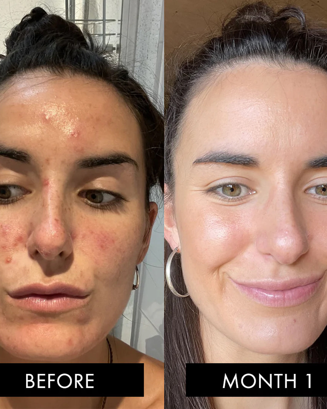 The Skin Elixir